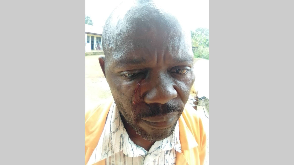 Insécurité : Un agent des TP agressé sur le chantier Ndendé-Doussala
