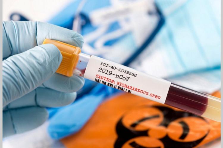 Covid-19 : retour au travail possible, malgré un test positif, après 14 jours
