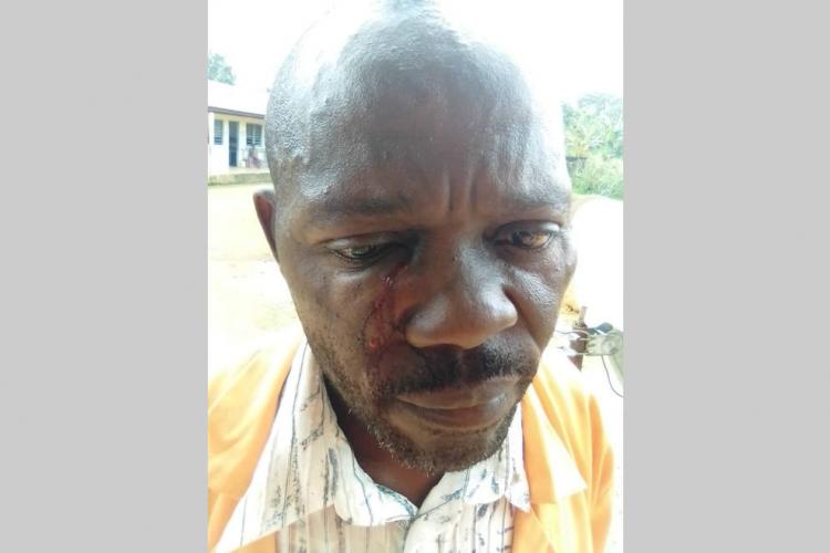 Insécurité : Un agent des TP agressé sur le chantier Ndendé-Doussala
